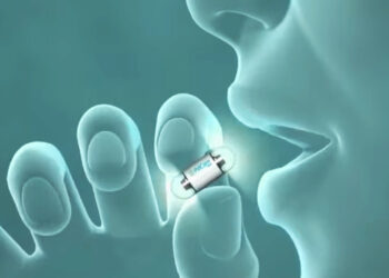 L’endoscopia in pillole