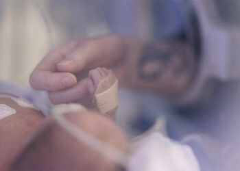 Immagini del reparto neonatale del Bristol Southmead Hospital