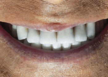 Realpolitik italiana Santese Valli